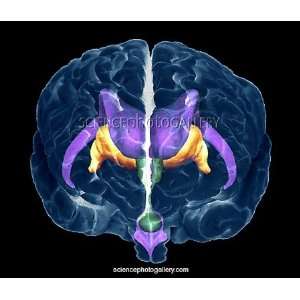  Brain ventricles and other structures Framed Prints