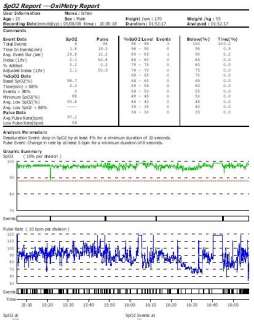Vet Animals Pulse Oximeter Spo2 Monitor CMS60C CE  