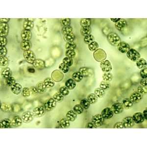 Nostoc Cyanobacteria, with Heterocysts Important in Nitrogen Fixation 