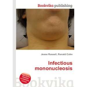  Infectious mononucleosis Ronald Cohn Jesse Russell Books