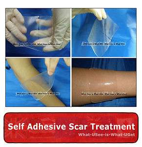 12cm X 8cm Silicone Gel Scar Treatment Sheet Reduce Scaring  