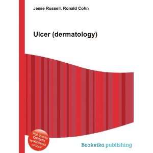  Ulcer (dermatology) Ronald Cohn Jesse Russell Books