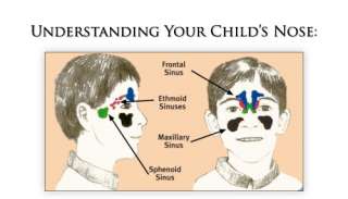 SinuCleanse Kids Mist Refills Sinus Nasal Congestion  